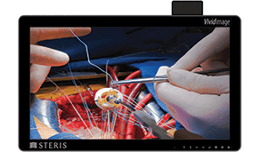 VIVIDIMAGE® D Операционный монитор